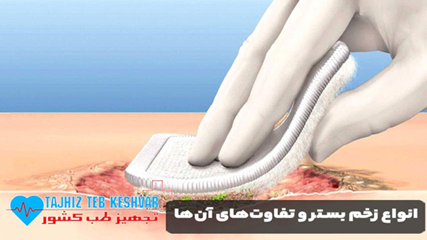 انواع زخم بستر و تفاوت ‌های آن ‌ها