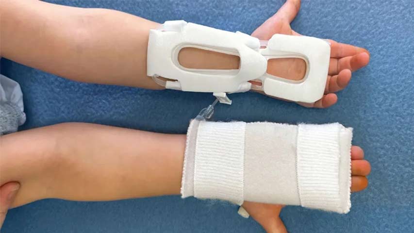 اتل بلو اسپلینت